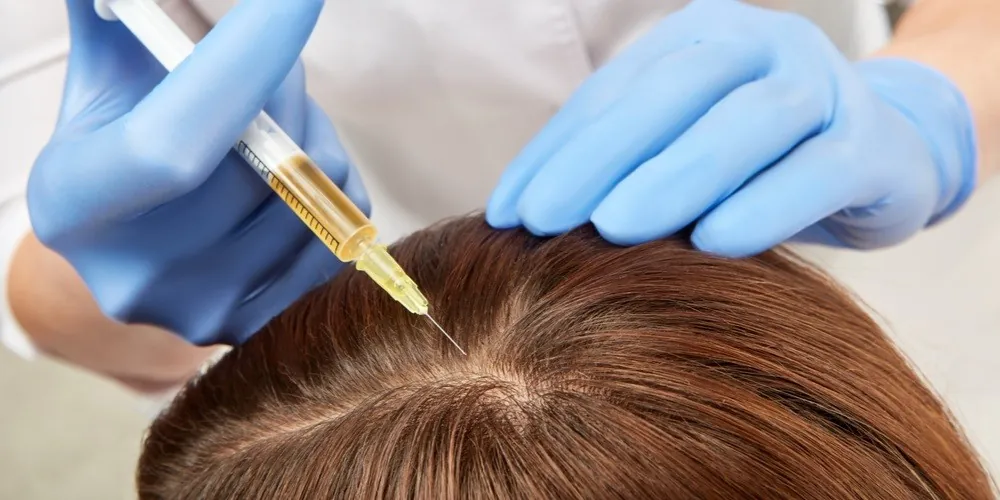 Platelet Rich Plasma