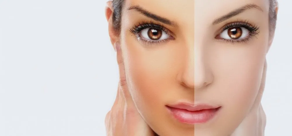 Skin Lightening Treatment in Bangalore