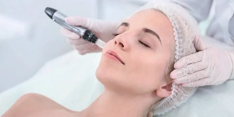 Microneedling for scars in Bangalore