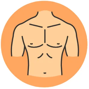 Gynecomastia