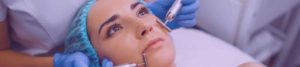facial laser resurfacing microneedling for acne scars