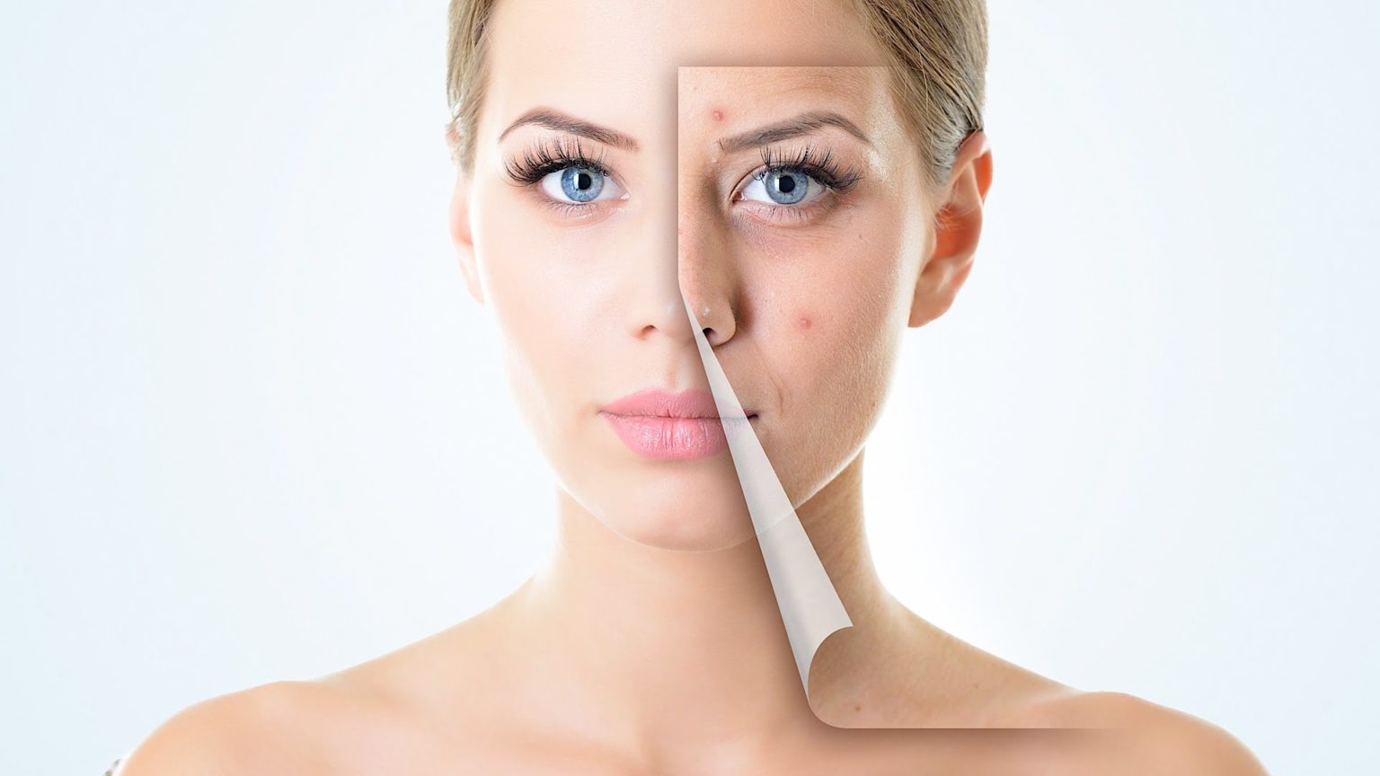 Plastic surgery for Scars on Face Acne Scar Surgery in Bangalore Scar Treatment