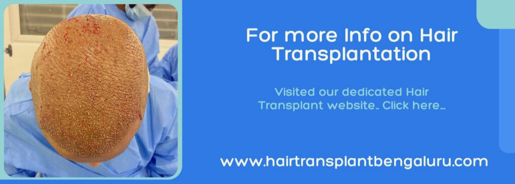 hair transplant surgery in bangalore