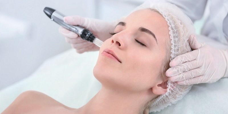 Microneedling for scars in Bangalore